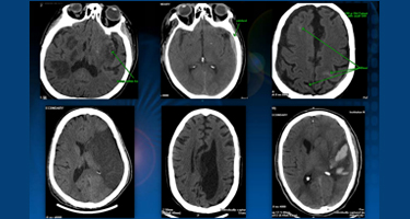 CaseStudy_CurrentSolutionsInSpineStudies_375px